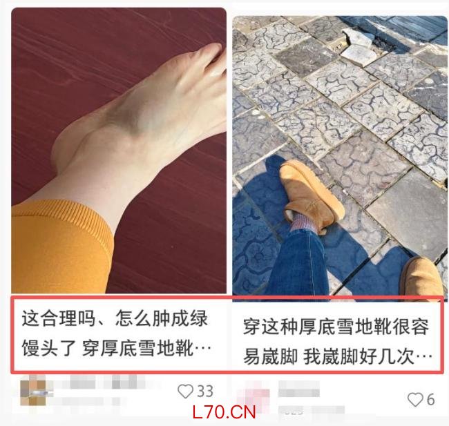 这3种网红鞋可能正在毁掉你的脚 藏在鞋柜里的“健康杀手”