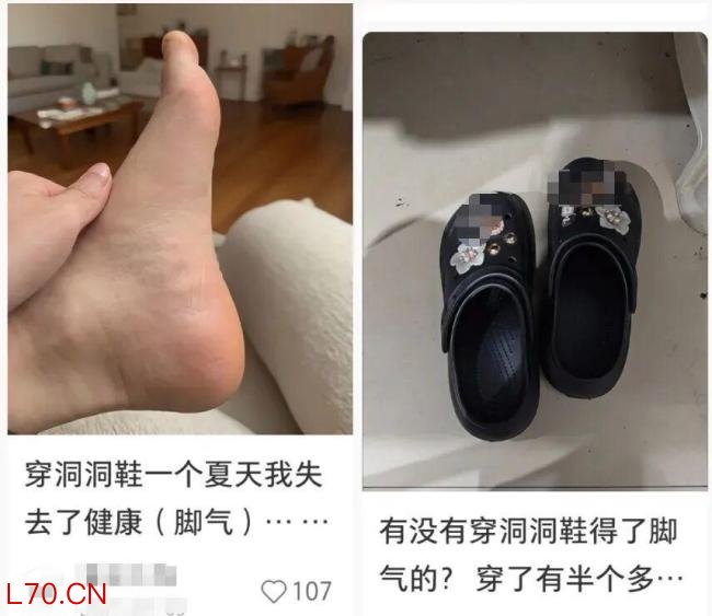 这3种网红鞋可能正在毁掉你的脚 藏在鞋柜里的“健康杀手”